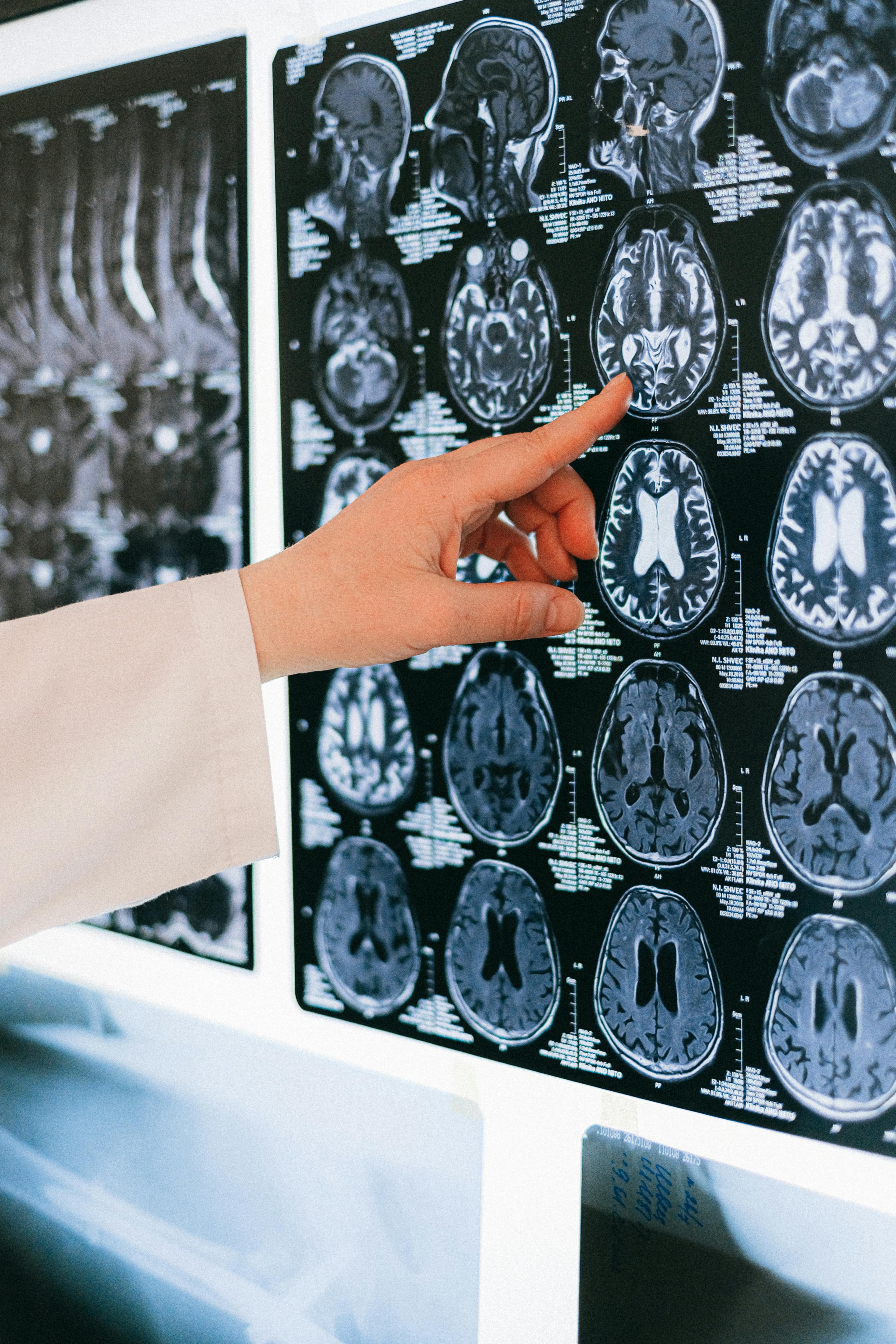 Neurology