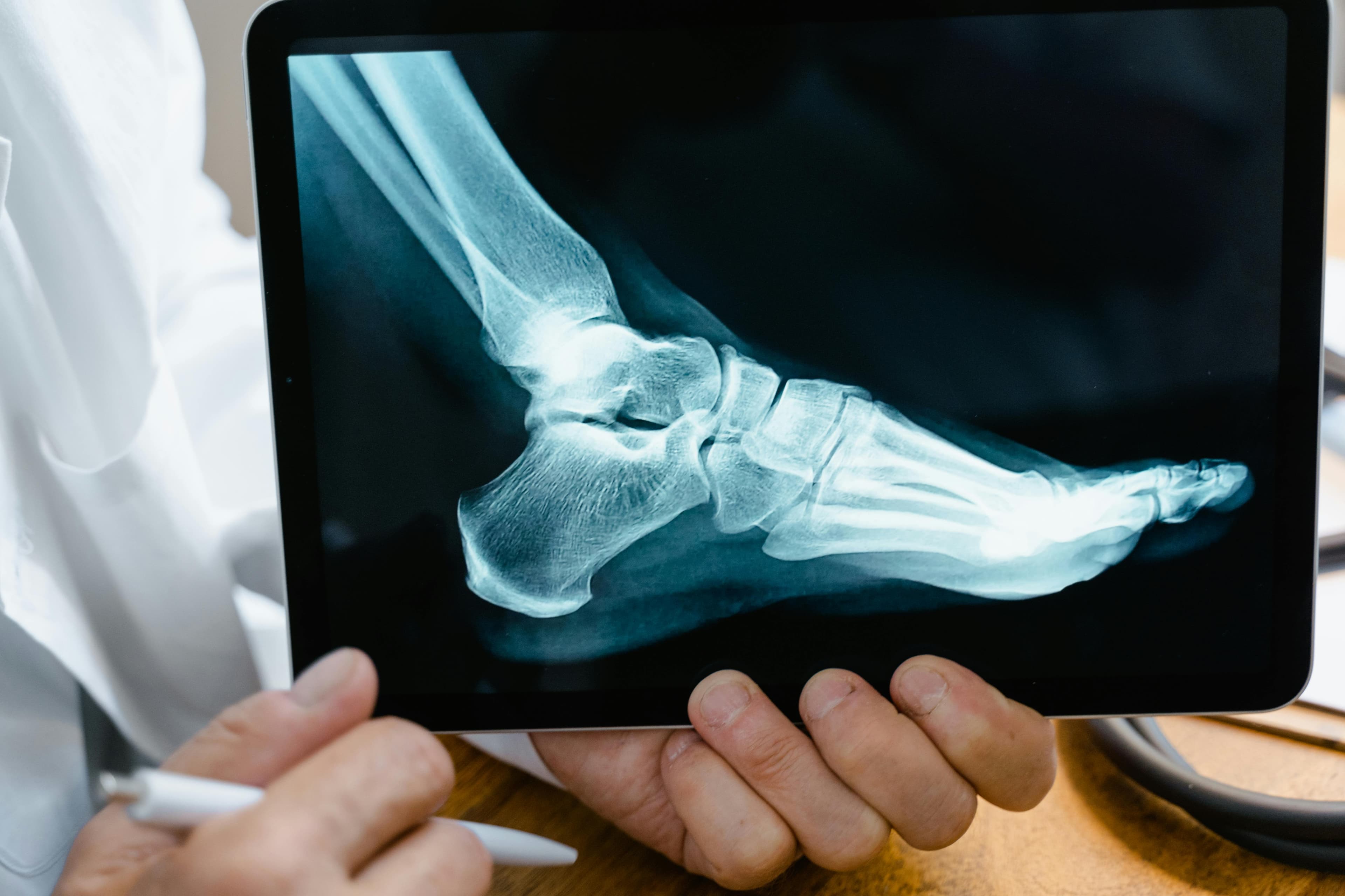 Orthopedics